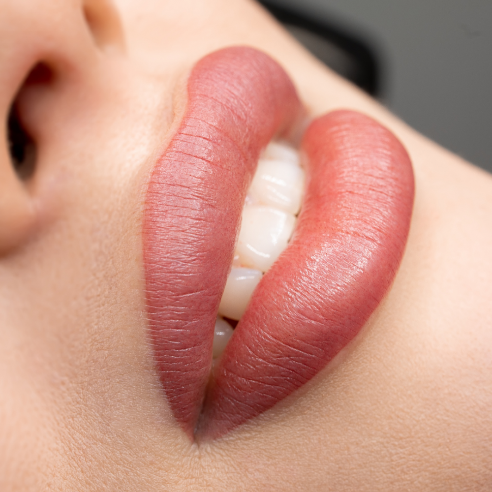 Lip Filler Victory Wellness & Med Spa Naples Achieve Radiant Health