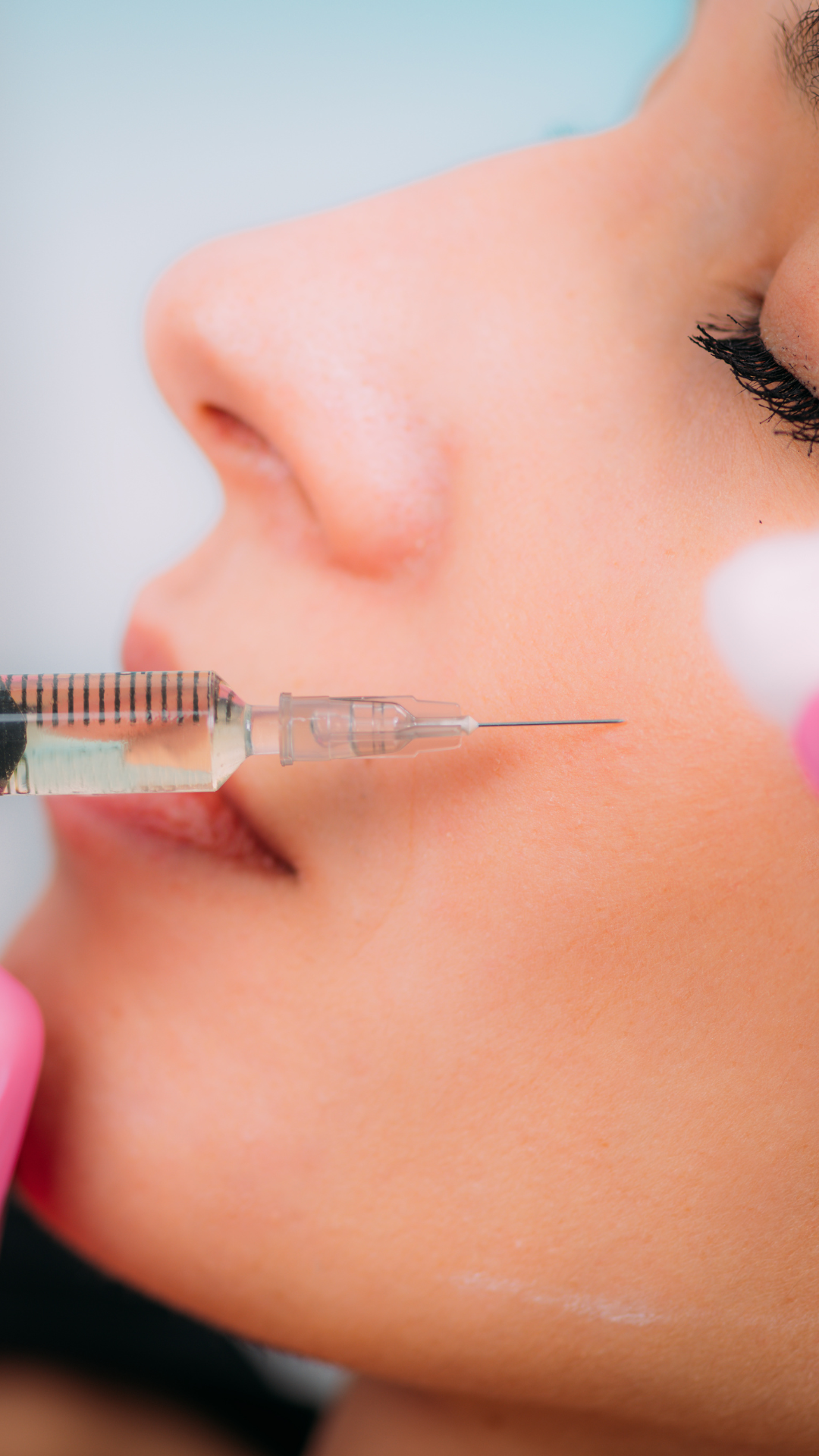 Cheek Filler in Naples, Florida